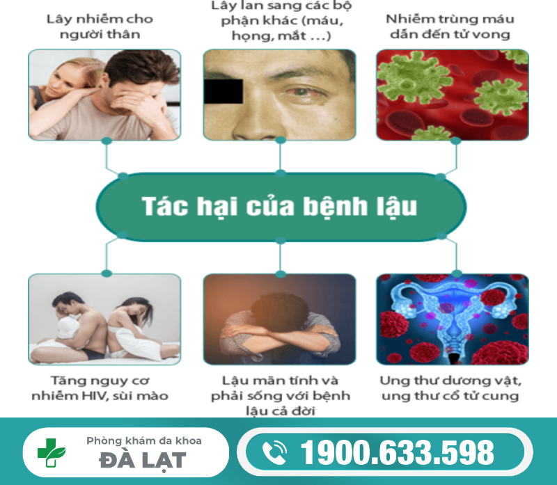 Hình ảnh minh họa